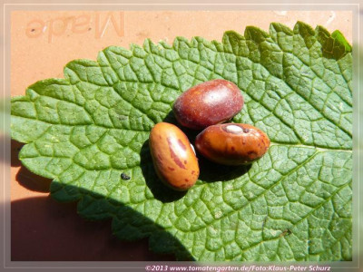 BB_Kidney_Andrwe_Kent02.jpg