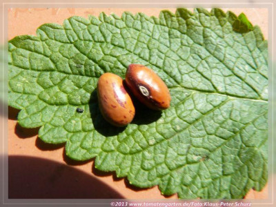 BB_Kidney_Andrwe_Kent03.jpg