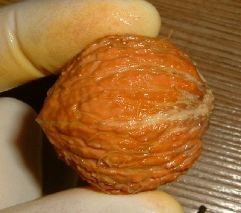 unbek_nuss03.jpg