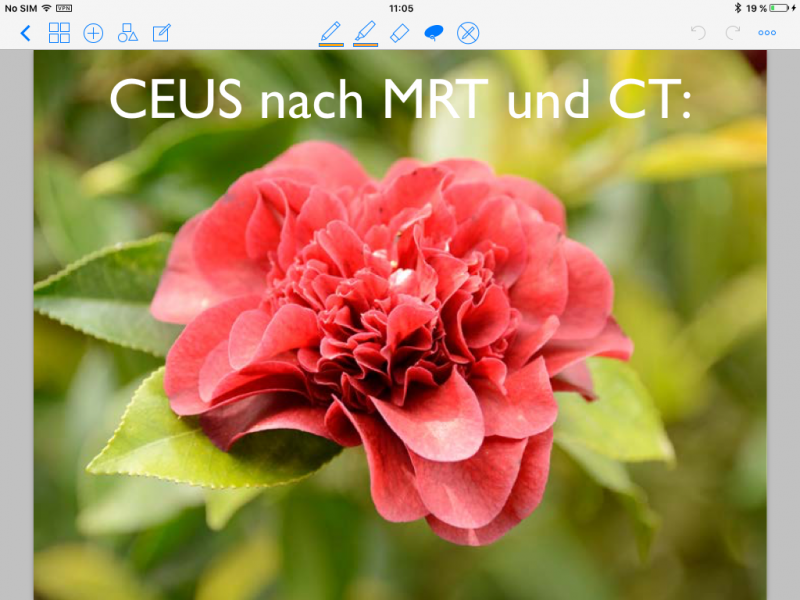 Nummer 1