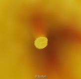 YGNRFNarbe